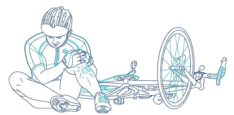 Ilustración: accidente con bicicleta o patinete